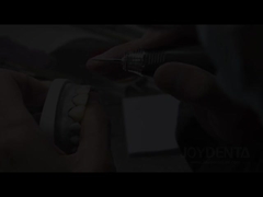 Grasshopper Veneers Solusi yang Sempurna untuk Garis Gigi Translucence Alam