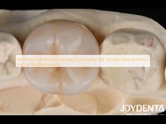 Multilayer Full Zirconia Kombinasi Ultimate Kekuatan Dan Estetika Untuk Restorasi Gigi