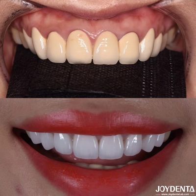 CAD/CAM Kompatibel Zirconia Dental Crown Precision Manufacturing untuk nuansa dan ukuran yang disesuaikan