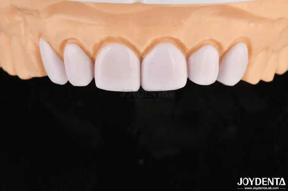 Beli Veneer Gigi untuk Gigi yang Tidak Selaras Biokompatibilitas dan lembut pada jaringan mulut pembuatan online