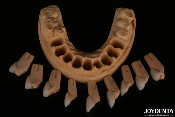 Beli Furnir Dental Feldspathic yang Tepat Sangat Alami Dengan Tekstur Permukaan Glossy pembuatan online