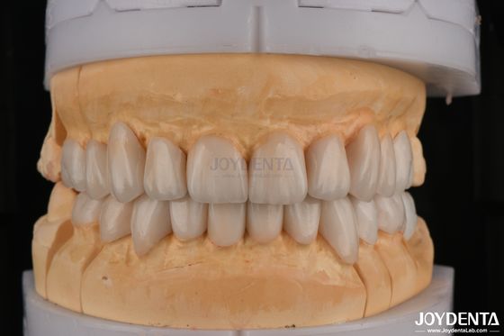 Beli Zirconia Berlapis Translucence Tinggi Untuk Restorasi Gigi Full Contour pembuatan online