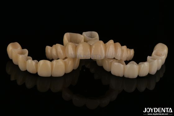 Beli Jembatan Zirconia berlapis Porselen yang terlihat alami ketahanan haus Biokompatibilitas tinggi pembuatan online