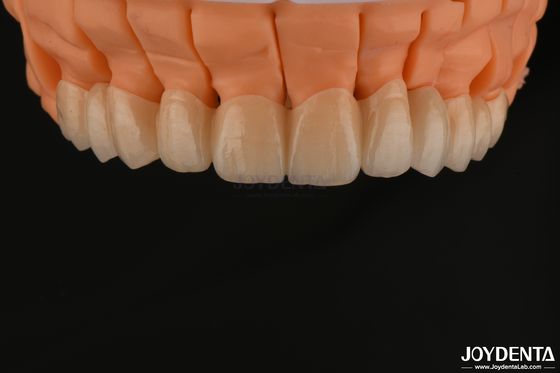 Beli Estetika Tinggi Layered Zirconia Single Crown Bridges Implantasi untuk Restorasi Gigi pembuatan online
