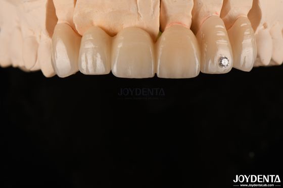 Beli CAD / CAM penggilingan gigi berlapis Zirconia Untuk mahkota tunggal 0.3-0.5mm ketebalan lapisan pembuatan online