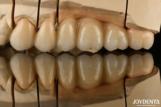 Beli Mirip alami Multilayer Full Zirconia Untuk Restorasi Gigi Ultra Translucent pembuatan online