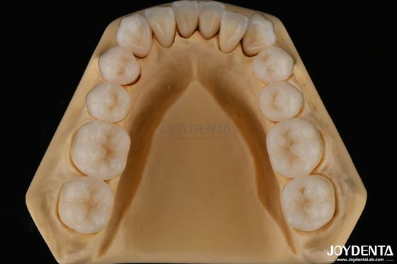 Beli 3D Multilayer Dental Full Zirconia Resistance Chipping Struktur gigi alami pembuatan online