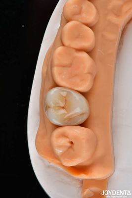Beli Dental Multilayer Full Zirconia Mahkota Dan Jembatan Tinggi Translucent Natural Looking pembuatan online