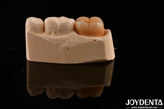 Beli Bahan Restorasi Gigi Multilayer Full Zirconia 1200 HV Kekerasan Resistensi Retak pembuatan online