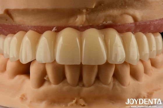 Beli Solusi Gigi Ti-Base Zirconia Hybrid Bridge Biokompatibilitas Tinggi Penampilan alami pembuatan online