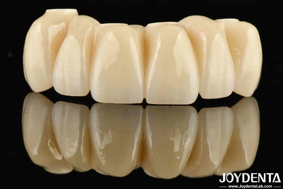 Beli Restorasi Gigi Ti-Base Zirconia Hybrid Bridge Natural Looking Precise Fit pembuatan online