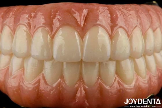 Beli Precise Fit Dental Ti-Bar Zirconia Hybrid Bridge Replacement Untuk Gigi Yang Hilang pembuatan online