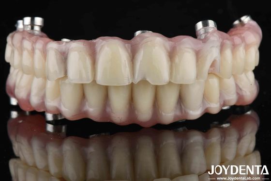 Beli Natural Look Dental Laboratory Acrylic Teeth Finish Untuk High Wear Resistance pembuatan online