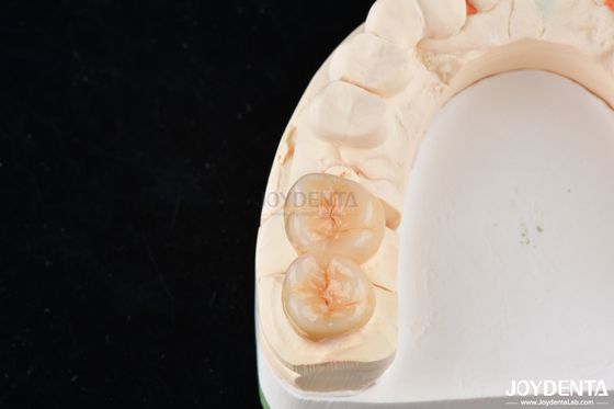 Beli Inlay dan Onlays Zirconia Gigi yang terlihat alami Sangat pas secara estetis pembuatan online
