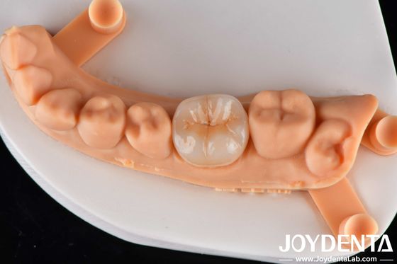 Beli Translucent Zirconia Disc Block Untuk Inlay Onlay Crown Restoration Dan Bridge Frame pembuatan online