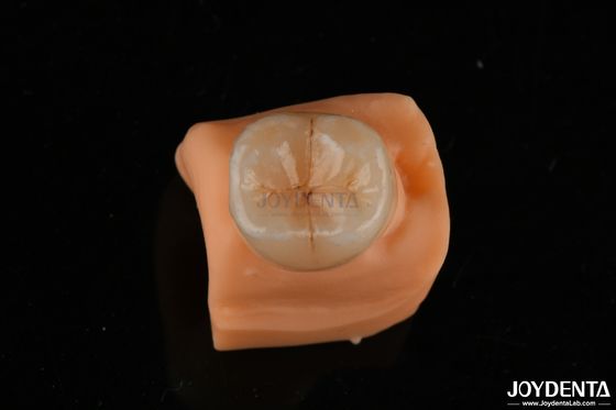 Beli 0.5mm tahan noda Emax Inlay Onlay Pas tepat untuk restorasi gigi pembuatan online