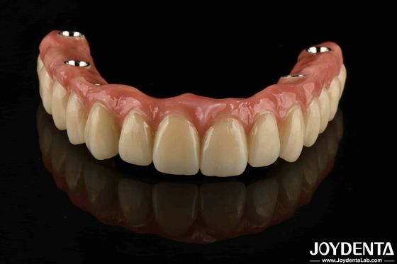 Beli Custom Titanium Malong Dental Hybrid Jembatan Korosi Tahan Penyesuaian pembuatan online