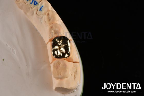 Beli Resistensi abrasif Dental Wax Casting FMC Crown Untuk Perbaikan Klinis Oral pembuatan online