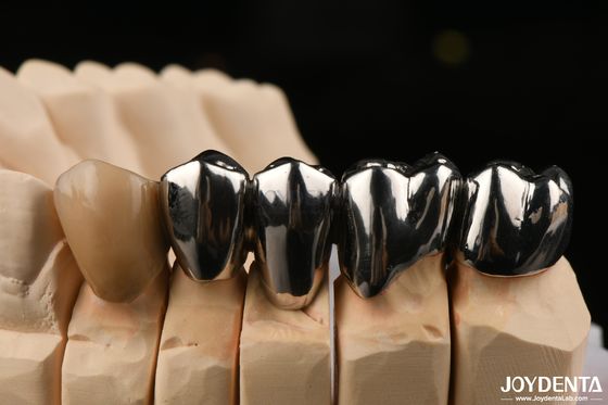 Beli Perbaikan Klinis Oral FMC Full Metal Crown Made With Wax Casting Metode Produksi pembuatan online