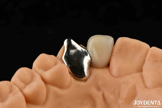 Beli Bahan logam yang dapat disesuaikan PFM Maryland Perawatan gigi Perbaikan klinis oral pembuatan online