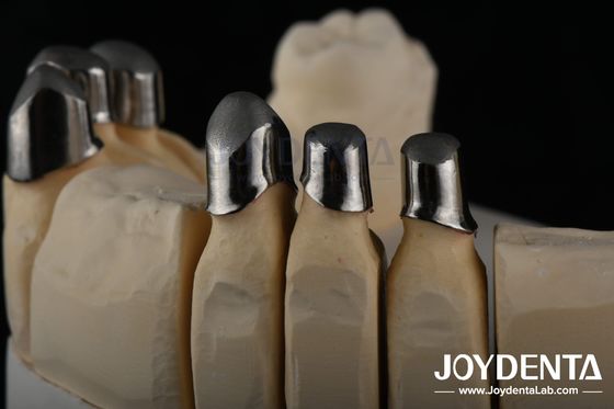 Beli Steel Locator Dental Attachments, Precision Partial Denture Attachments yang bisa dilepas pembuatan online