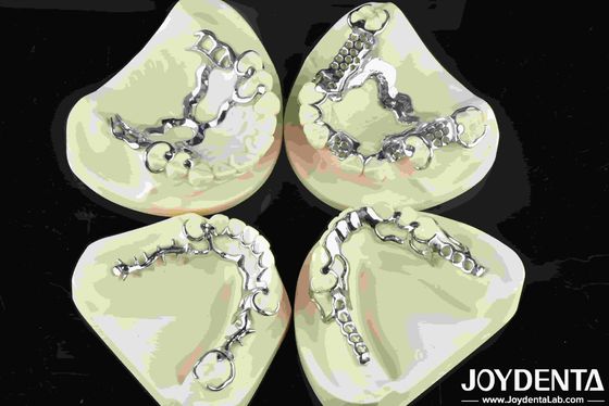 Beli Good Fit Dental Metal Frame Bahan logam untuk restorasi gigi yang tahan lama pembuatan online