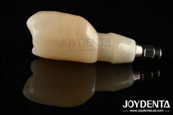 Beli Desain Margin Bahu Bar Implan Gigi Untuk Kebutuhan Platform Prosthetic Luas pembuatan online