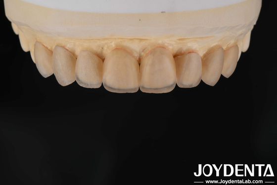 Beli Penampilan alami Kaca keramik veneers, Klinik gigi veneers Ikatan kuat pembuatan online