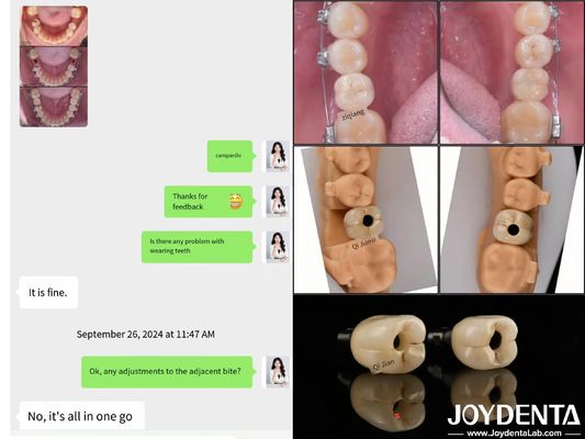 Beli Implan Gigi Lengkung Panjang 10mm-16mm pembuatan online