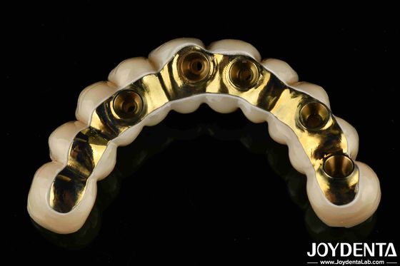 Beli Custom Made Ti-Bar Zirconia Hybrid Bridge Precision Fit Prosthesis Gigi pembuatan online