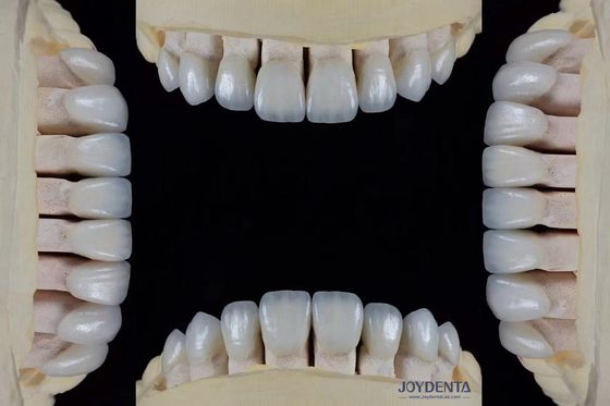 Beli Ultra Thin Feldspathic Veneer 0.3-0.5mm Ketebalan tahan noda tinggi Pas tepat pembuatan online