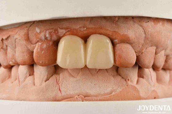 Beli Multilayer PMMA Polymethyl Methacrylate Untuk Restorasi Gigi pembuatan online