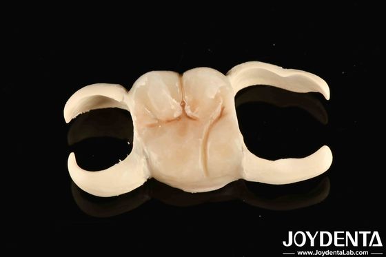 Beli M75 Kekerasan PMMA Bahan Dental Discs Resistant Scratch Untuk CAD / CAM Sistem pembuatan online