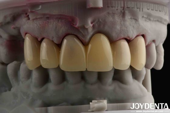 Beli CAD CAM Processing Dental PMMA Material Multilayer Design Untuk Transisi Bayangan Alami pembuatan online