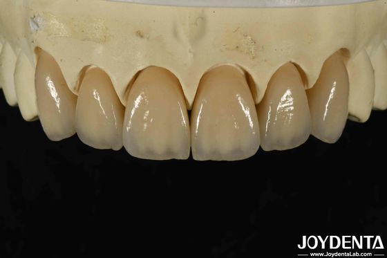 Beli Biokompatibilitas yang sangat baik Zirconia berlapis Dalam Estetika dan Densitas Tinggi 6.0-6.1 G / cm3 pembuatan online