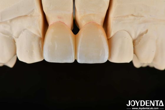 Beli 1350-1450°C Sintering Temperature Layered Zirconia Untuk Biokompatibilitas dan Konduktivitas Termal yang Lebih Tinggi pembuatan online