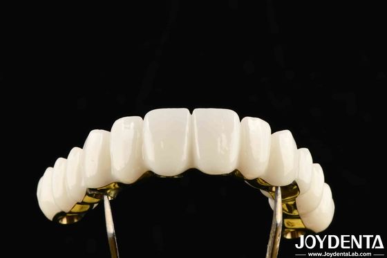 Beli Custom Made Zirconia Kekuatan yang sangat baik untuk solusi gigi individual pembuatan online