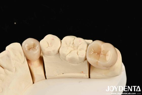 Beli Biokompatibilitas yang sangat baik Zirconia penuh dengan ketahanan tinggi terhadap korosi dan kekuatan lentur 1000 MPa pembuatan online