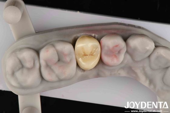 Beli Kekuatan Patah 9 MPa·m1/2 Estetika Tinggi Ketahanan Pakai Tinggi Zirconia penuh pembuatan online