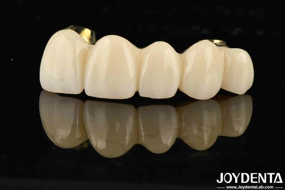 Beli Kekuatan yang sangat baik Ti-Bar Zirconia Hybrid Bridge Untuk Kompatibilitas Gigi dan Gusi Alam pembuatan online