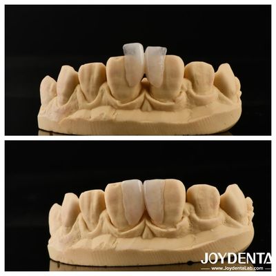 Beli Mudah Dipasang Micro Veneer Solusi Utama Untuk Dekorasi Interior Ketebalan 0,2mm pembuatan online