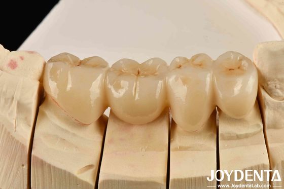 Beli Bebaskan Estetika dari Estetika Tinggi Zirconia penuh dengan putih dan tahan terhadap kelelahan panas tinggi pembuatan online