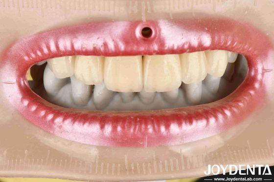 Beli Layered Zirconia High Aesthetics Excellent Biocompatibility Sintering Temperature 1350-1450°C Untuk Bahan Lanjutan pembuatan online