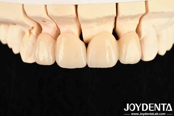 Beli Konduktivitas termal Zirconia berlapis translucence tinggi 3 W/mK untuk kinerja yang luar biasa pembuatan online