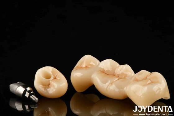 Beli Multilayer Full Zirconia High Resistance To Cracking And Durability For Long Lasting Dental Restorations pembuatan online