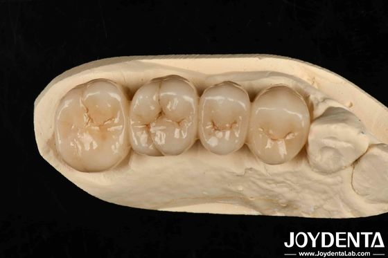 Beli Multilayer Full Zirconia Gaya Putih Dengan Lapisan Translucence Tinggi Resistensi Tinggi Untuk Retak pembuatan online