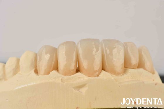 Beli Biarkan Cahaya Menari Di Zirconia Bangunan Transparansi Enamel Dan Kehangatan Dentin pembuatan online