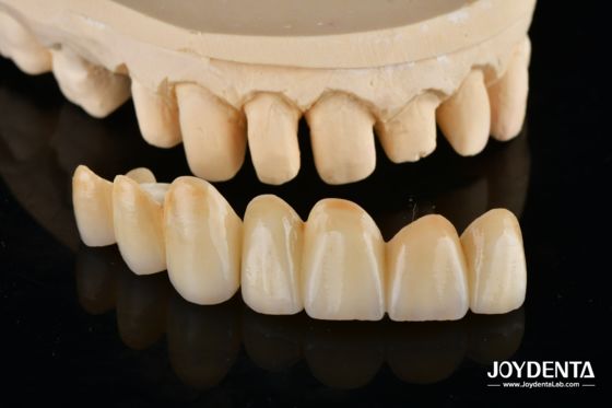Beli Unveil True Biomimicry: Introducing Our Multi-Layered Zirconia Aesthetic Bridge pembuatan online