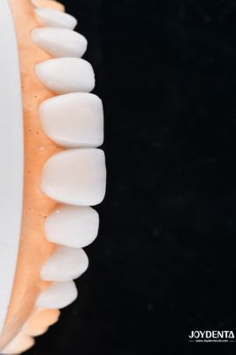 Beli Enhance Case Acceptance & Patient Communication with Our Diagnostic Wax-Up Service pembuatan online