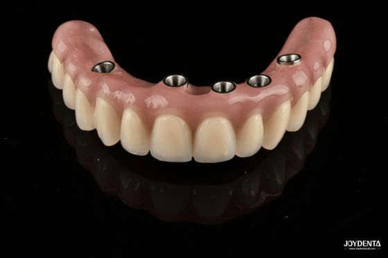 Beli Redefining Full Arch Prosthetics: Unmatched Fit and Function with Our Ti-Base Complete Dentures pembuatan online